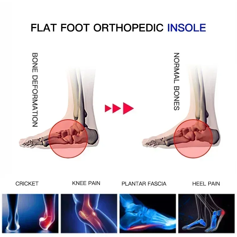 전문가용 아치 서포트 인솔 평발 교정 신발 쿠션 정형외 - Cycling Shoe Insoles 리뷰 및 가격